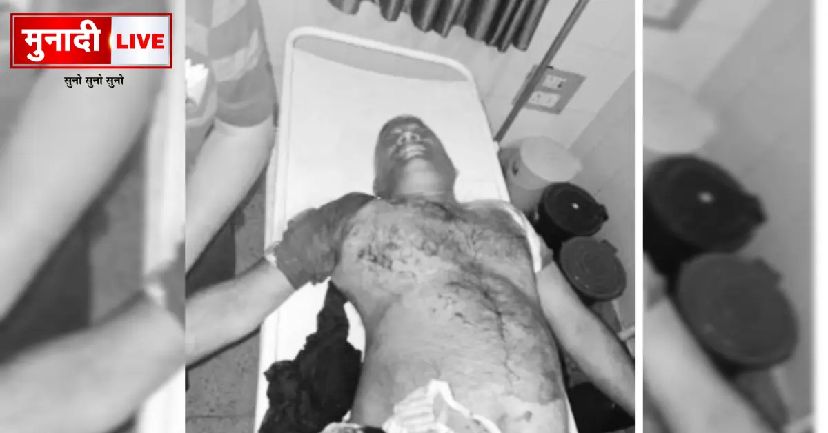 Para teacher shot by criminals