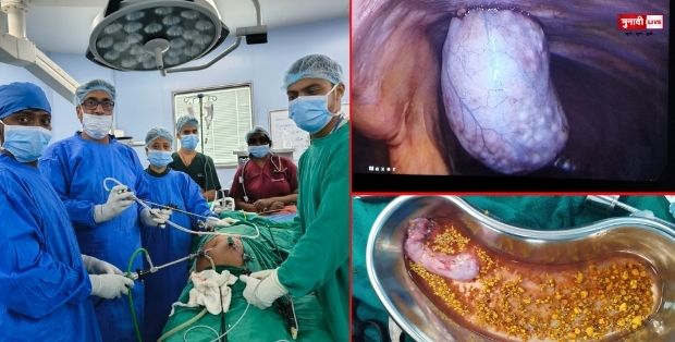 रांची सदर अस्पताल