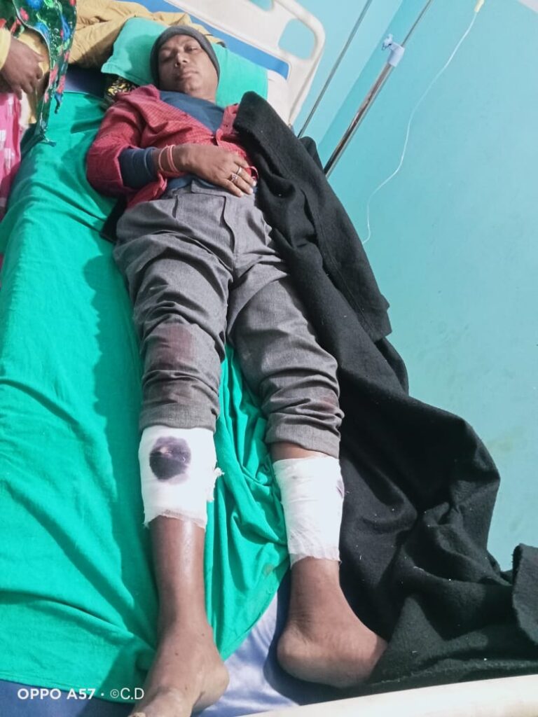 ईचागढ़ में पुलिस पर हमला: अवैध वसूली को लेकर बड़ा बवाल, स्थिति तनावपूर्ण 8 WhatsApp Image 2025 11 19 at 13.24.41 1